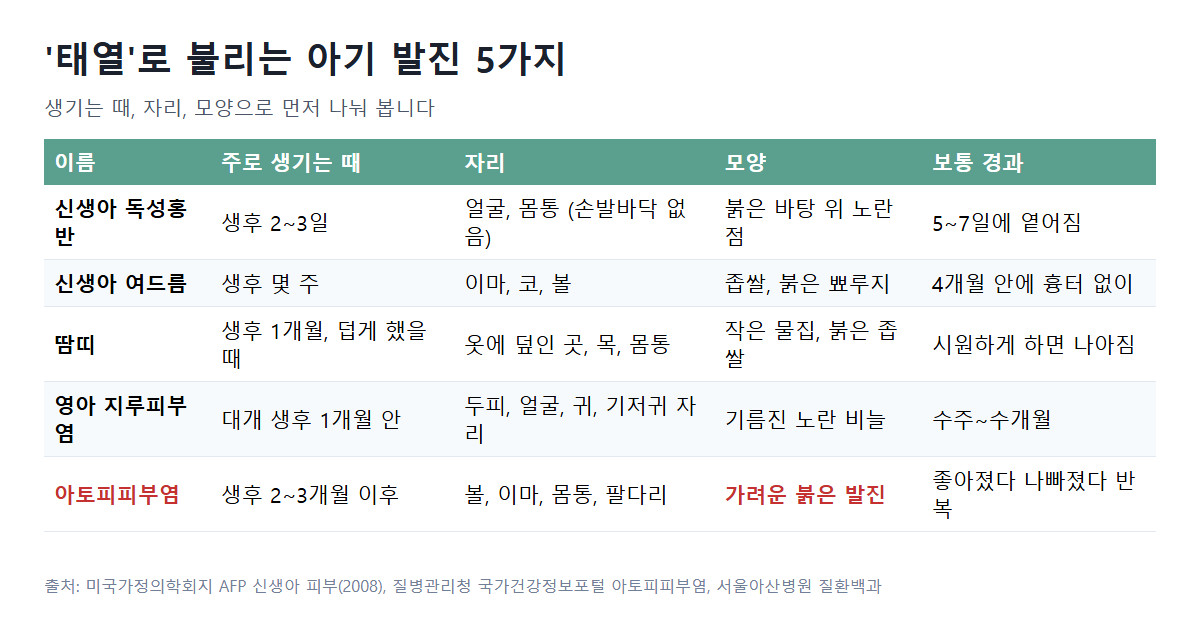 태열로 불리는 아기 발진 5가지 비교: 신생아 독성홍반, 신생아 여드름, 땀띠, 영아 지루피부염, 아토피피부염의 생기는 때, 자리, 모양, 경과