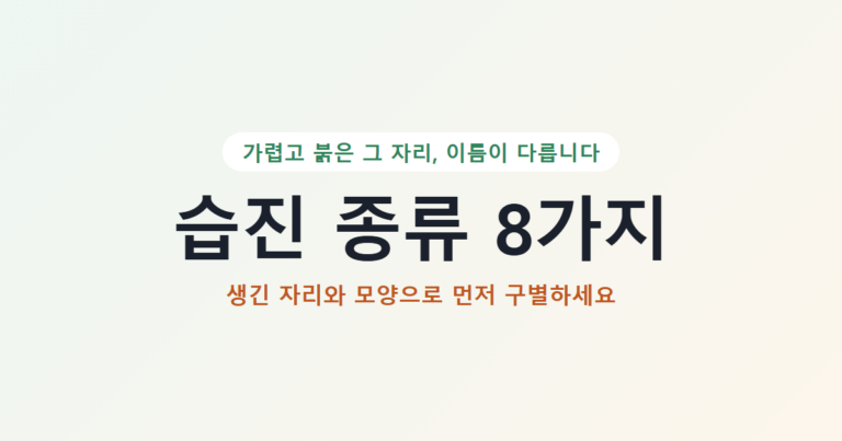 습진 종류 8가지, 생긴 자리와 모양으로 먼저 구별하세요 대표 이미지