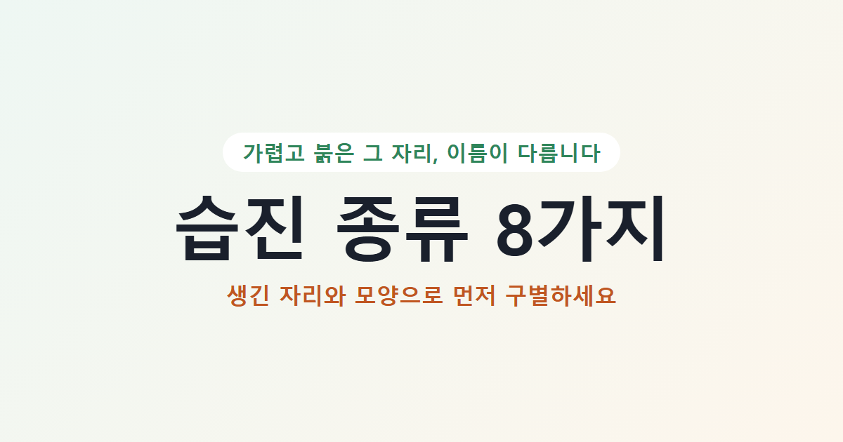 습진 종류 8가지, 생긴 자리와 모양으로 먼저 구별하세요 대표 이미지