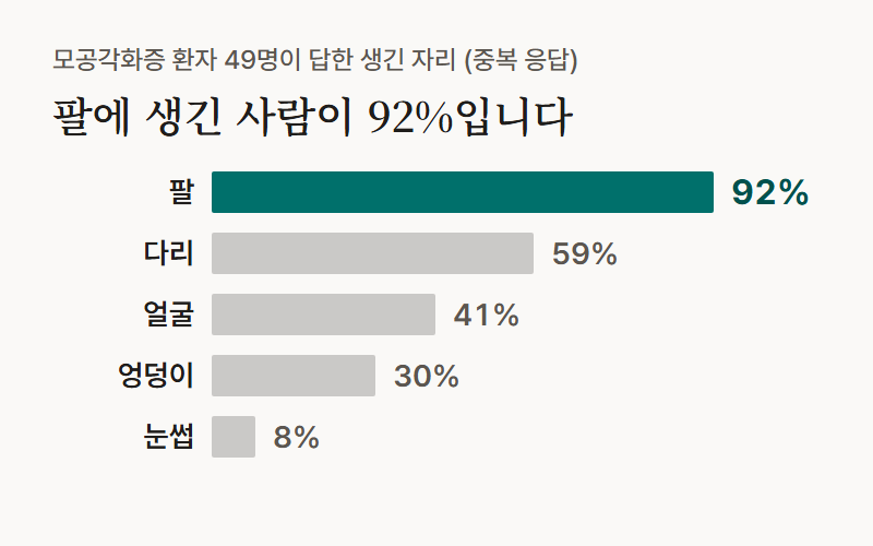 막대 그래프: 모공각화증 환자 49명 가운데 팔에 생긴 사람이 92%로 가장 많았고 다리 59%, 얼굴 41%, 엉덩이 30%, 눈썹 8% 순이었습니다.